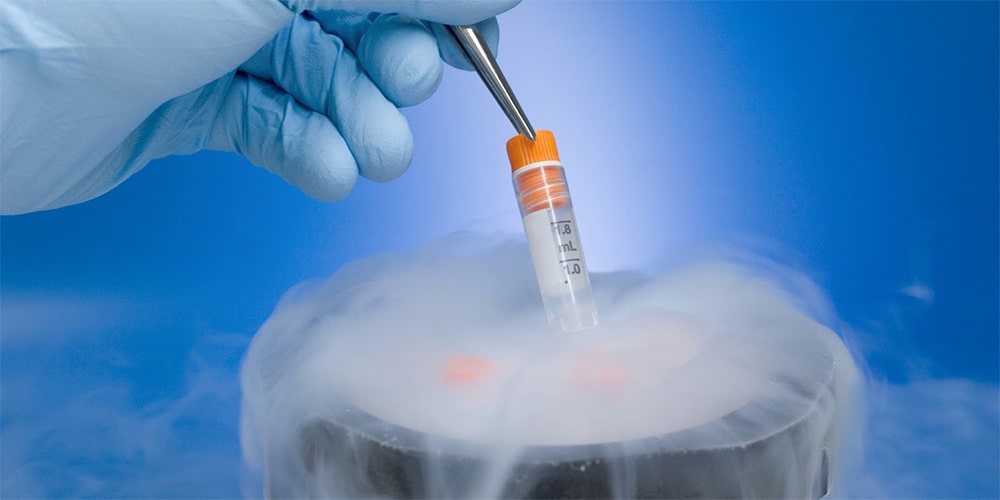 Best IVF Specialist in Bangalore - IVF Cost in Bangalore