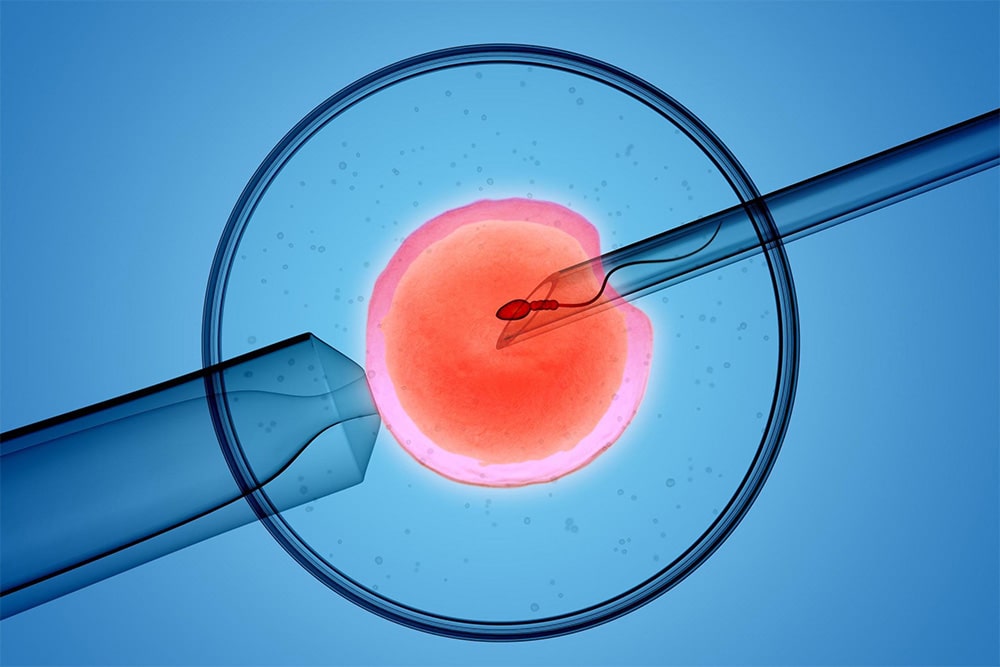 Infertility specialist in Bangalore - Best IUI Centres in Bangalore